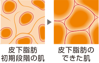 図：ミリオンウェーブイメージ