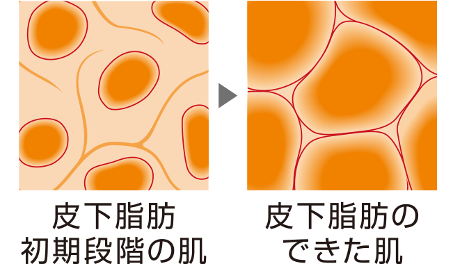 図：ミリオンウェーブイメージ