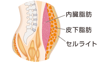 図：ファットバーンイメージ